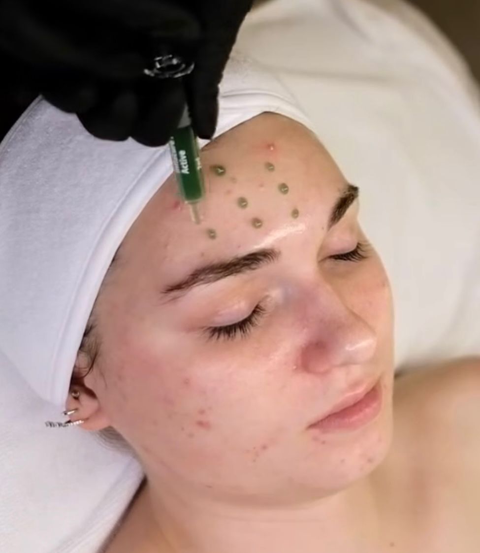 Inflacure Healing Sarkisian Skin Institute