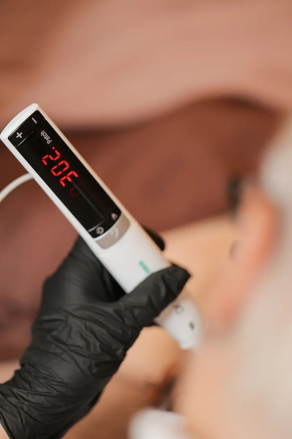 Detail van het cold plasma handstuk met digitaal display in een gehandschoende hand