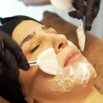 Een CO2-masker wordt met een waaierkwast aangebracht tijdens een carboxytherapie