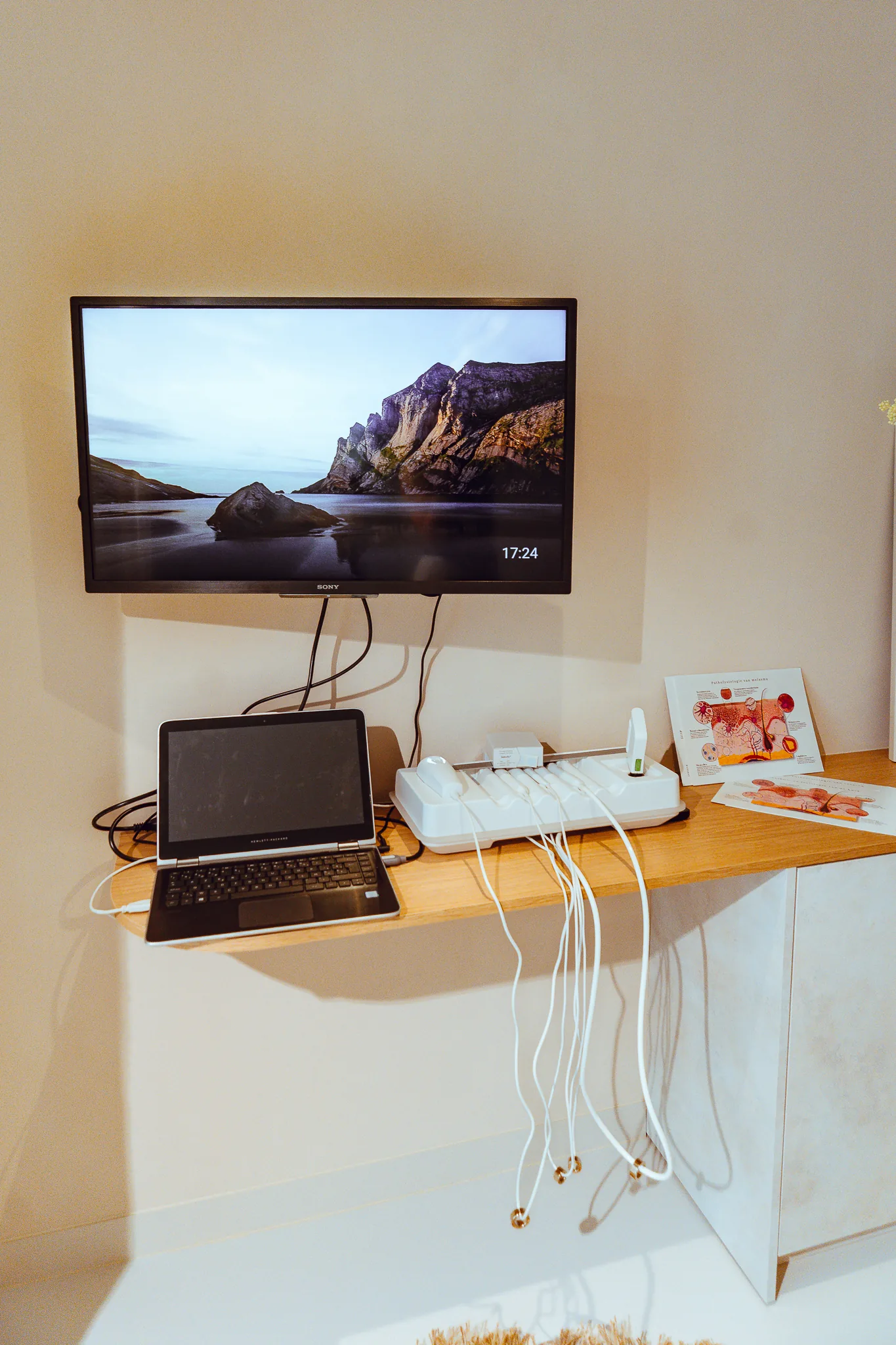 Toestel voor de huidanalyse met laptop en scherm